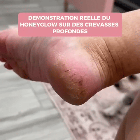 ✨ HoneyGlow™ – Kit Beauté Pieds