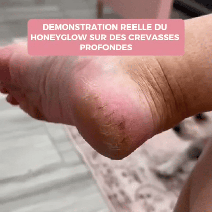 ✨ HoneyGlow™ – Kit Beauté Pieds